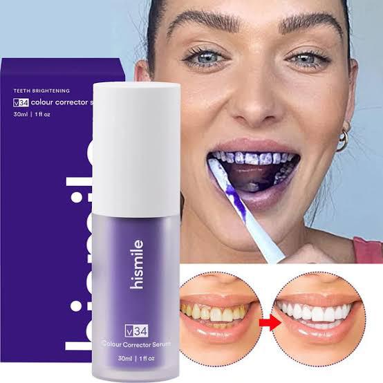 ✨ Achieve a Radiant Smile with V34 Whitening Solution 😁✨